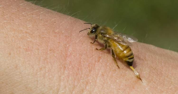 arı ısırması