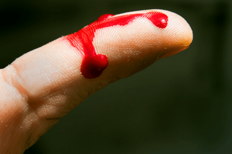 parmaktan kan akması