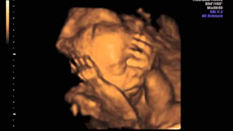 ultrasonda erkek bebek görmek