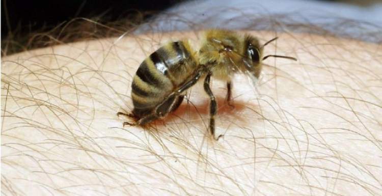 arı tarafından sokulmak