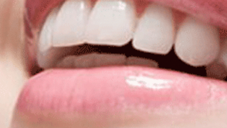 diş parçası