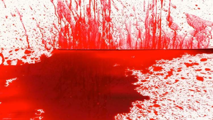 ölmüş insan kanı görmek