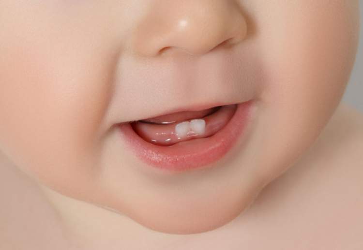 yeni doğan bebeğin diş çıkarması