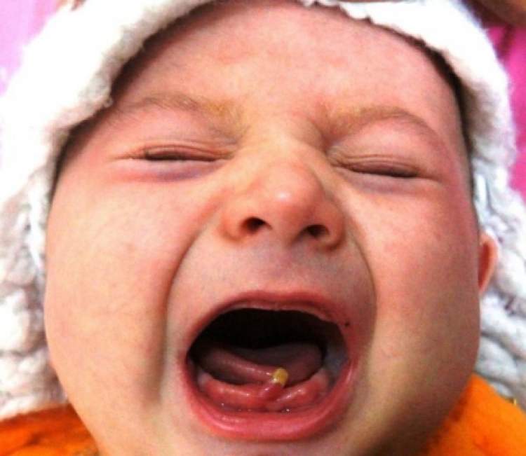 Rüyada Yeni Doğan Bebeğin Dişinin Olması - ruyandagor.com